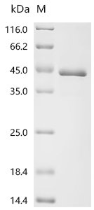 Human Filamin-C (FLNC), partial Recombinant Protein, C-His, aa 1–265, E.coli, Homo sapiens (Human), E.coli, C-terminal 6xHis-tagged, 37.3 kDa, purity >≥ 95% as determined by SDS-PAGE.