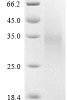 Human Low-density lipoprotein receptor-related protein 2 (LRP2), partial Recombinant Protein - BioCrest Sci