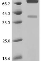 Mouse Glypican-3 (Gpc3), partial, Biotinylated Recombinant Protein - BioCrest Sci