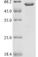Puumala virus Nucleoprotein (N) Recombinant Protein - BioCrest Sci