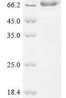 Human cytomegalovirus Protein UL141 (UL141), partial Recombinant Protein - BioCrest Sci