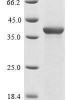 Human Cyclin-dependent kinase 5 (CDK5) Recombinant Protein, N-10His - BioCrest Sci