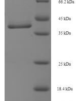 Human Protein MIS12 homolog (MIS12) Recombinant Protein - BioCrest Sci