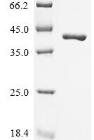 Mouse Glutathione S-transferase Mu 1 (Gstm1), partial Recombinant Protein, N-His-SUMO - BioCrest Sci