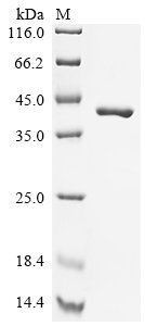 Mouse Glutathione S-transferase Mu 1 (Gstm1), partial Recombinant Protein, N-His-SUMO, Mus musculus (Mouse), E.coli, N-terminal 6xHis-SUMO-tagged, 38.8 kDa, purity >≥ 90% as determined by SDS-PAGE.