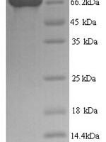 Human BRCA1-associated protein (BRAP) Recombinant Protein - BioCrest Sci