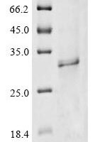 Human Protein Wiz (WIZ), partial Recombinant Protein, C-His-Myc - BioCrest Sci