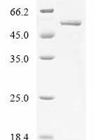 Human Protein cereblon (CRBN) Recombinant Protein, C-His - BioCrest Sci