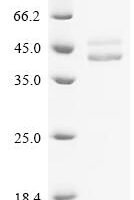Human Guanine nucleotide-binding protein G(q) subunit alpha (GNAQ) Recombinant Protein, N-Flag/C-8His - BioCrest Sci