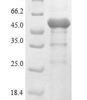 Pseudomonas aeruginosa UDP-3-O-acyl-N-acetylglucosamine deacetylase (lpxC) Recombinant Protein - BioCrest Sci