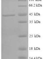 Human 11-beta-hydroxysteroid dehydrogenase 1 (HSD11B1), partial Recombinant Protein, N-His-SUMO - BioCrest Sci
