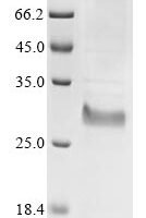 Bovine coronavirus Protein I (N) Recombinant Protein, C-His - BioCrest Sci
