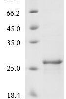 Mouse Heme-binding protein 1 (Hebp1) Recombinant Protein - BioCrest Sci