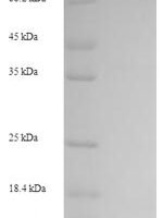 Human Unconventional myosin-XIX (MYO19) Recombinant Protein - BioCrest Sci