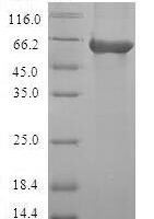 Human Carbonic anhydrase-related protein (CA8) Recombinant Protein - BioCrest Sci