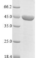 Mouse Dihydroorotate dehydrogenase (quinone),mitochondrial (Dhodh), partial Recombinant Protein - BioCrest Sci