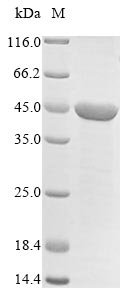 Mouse Dihydroorotate dehydrogenase (quinone),mitochondrial (Dhodh), partial Recombinant Protein, Mus musculus (Mouse), E.coli, N-terminal 6xHis-tagged, 45.0 kDa, purity >≥ 85% as determined by SDS-PAGE.