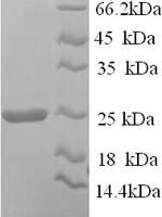 Human Hepatitis A virus cellular receptor 2 (HAVCR2), partial Recombinant Protein, N-His, aa 22–202, Yeast - BioCrest Sci