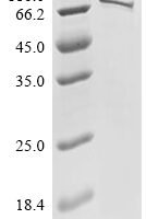 Human Syntaxin-binding protein 3 (STXBP3) Recombinant Protein - BioCrest Sci