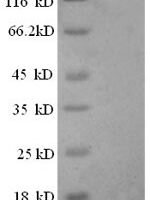 Human DNA ligase 1 (LIG1) Recombinant Protein, N-GST - BioCrest Sci