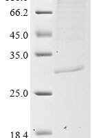 Human COMM domain-containing protein 5 (COMMD5) Recombinant Protein, N-10His/C-Myc, aa 2–224, Mammalian cell - BioCrest Sci