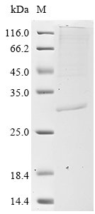 Human COMM domain-containing protein 5 (COMMD5) Recombinant Protein, N-10His/C-Myc, aa 2–224, Mammalian cell, Homo sapiens (Human), Mammalian cell, N-terminal 10xHis-tagged and C-terminal Myc-tagged, 29.5 kDa, purity >≥ 85% as determined by SDS-PAGE.