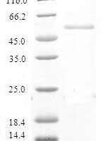 Human E3 ubiquitin-protein ligase RNF125 (RNF125) Recombinant Protein - BioCrest Sci