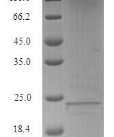 Human Lymphocyte antigen 6E (LY6E) Recombinant Protein - BioCrest Sci