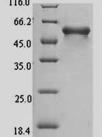 Mouse Mucosal addressin cell adhesion molecule 1 (Madcam1), partial Recombinant Protein - BioCrest Sci