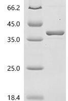 Human Glyceraldehyde-3-phosphate dehydrogenase (GAPDH) Recombinant Protein, N-His/C-HA - BioCrest Sci