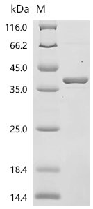 Human Glyceraldehyde-3-phosphate dehydrogenase (GAPDH) Recombinant Protein, N-His/C-HA, Homo sapiens (Human), E.coli, N-terminal 6xHis-tagged and C-terminal HA-tagged, 37.8 kDa, purity >≥ 90% as determined by SDS-PAGE.