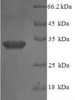 Human Interleukin-36 receptor antagonist protein (IL36RN) Recombinant Protein - BioCrest Sci