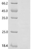 Mouse Proepiregulin (Ereg), partial Recombinant Protein, C-His - BioCrest Sci