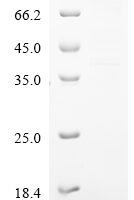 Human Band 4.1-like protein 5 (EPB41L5) Recombinant Protein, N-10His, aa 1–733, Baculovirus - BioCrest Sci