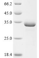 Human Carbonic anhydrase 5A, mitochondrial (CA5A) Recombinant Protein - BioCrest Sci