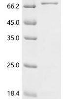 Escherichia coli Cytoplasmic trehalase (treF) Recombinant Protein, N-His - BioCrest Sci