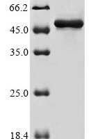 Human Actin-related protein 3 (ACTR3) Recombinant Protein, N-10His/C-Myc - BioCrest Sci
