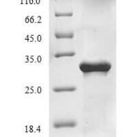Influenza A virus Matrix protein 1 (M) Recombinant Protein - BioCrest Sci
