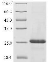 Human Immunoglobulin J chain (JCHAIN) Recombinant Protein, N-10His/C-Myc - BioCrest Sci