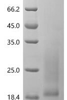 Human Interleukin-5 (IL5) Recombinant Protein, N-His - BioCrest Sci
