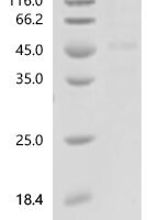 Rat NAD-dependent protein deacetylase sirtuin-2 (Sirt2) Recombinant Protein - BioCrest Sci