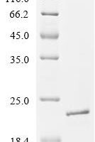 Arabidopsis thaliana Cytochrome c (CC-1) Recombinant Protein - BioCrest Sci