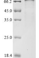 Neosartorya fumigata Probable pectate lyase C (plyC) Recombinant Protein, C-hFc1 - BioCrest Sci