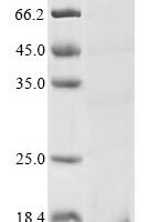 Naja atra Cytotoxin 2 Recombinant Protein - BioCrest Sci