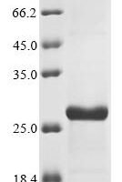 Human Eukaryotic translation initiation factor 4E (EIF4E) Recombinant Protein, Tag-Free - BioCrest Sci