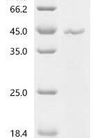 Pig Lepti（LEP) Recombinant Protein - BioCrest Sci
