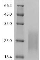 Human Seizure protein 6 homolog (SEZ6), partial Recombinant Protein, C-10His, aa 415–527, Mammalian cell - BioCrest Sci