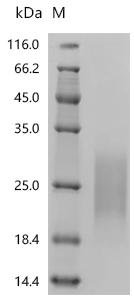 Human Seizure protein 6 homolog (SEZ6), partial Recombinant Protein, C-10His, aa 415–527, Mammalian cell, Homo sapiens (Human), Mammalian cell, C-terminal 10xHis-tagged, 14.0 kDa, purity >≥ 95% as determined by SDS-PAGE.
