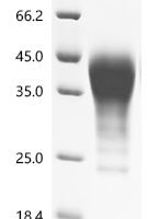 Mouse Leukemia inhibitory factor (Lif) Recombinant Protein, C-10His - BioCrest Sci