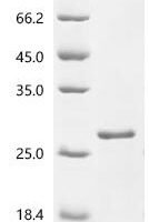 Dog Superoxide dismutase [Cu-Zn] (SOD1)(X53S) Recombinant Protein - BioCrest Sci